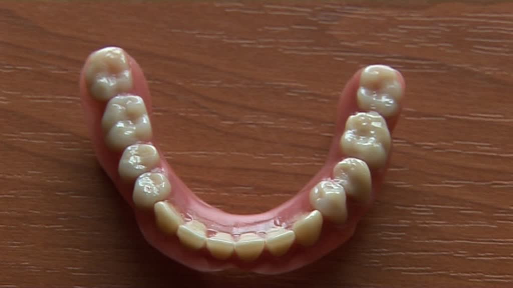 Dentier amovible sur implant pour la mandibule