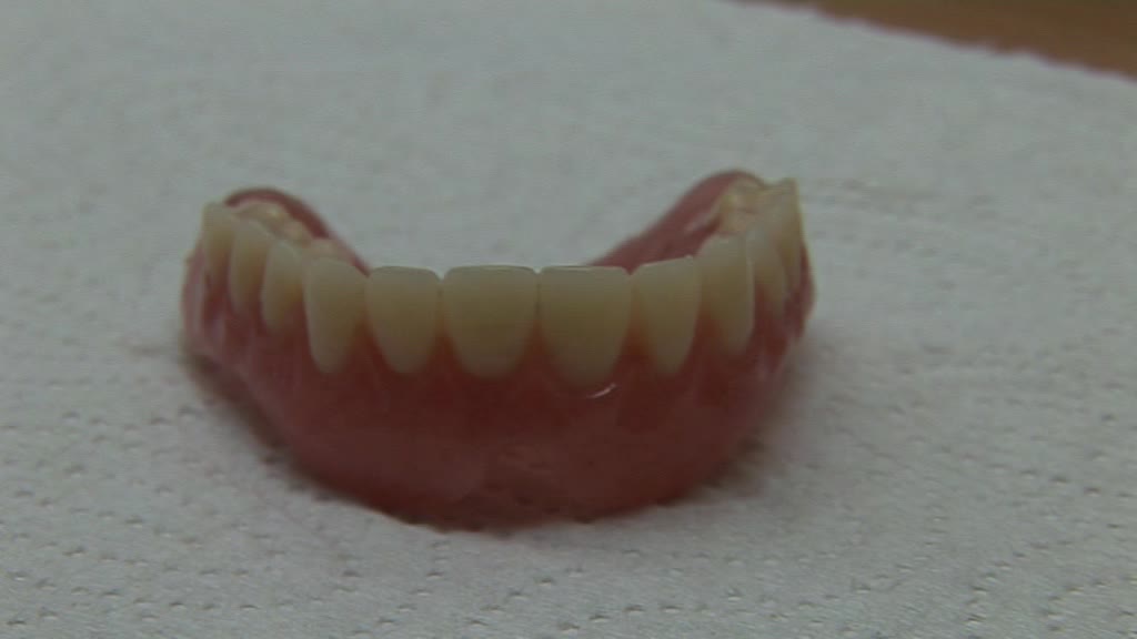 Une prothese complete avec des dents en résin sur la machoire supérieure