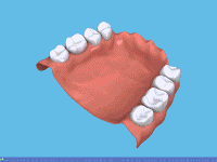 L'usage d'un fixatif dentier